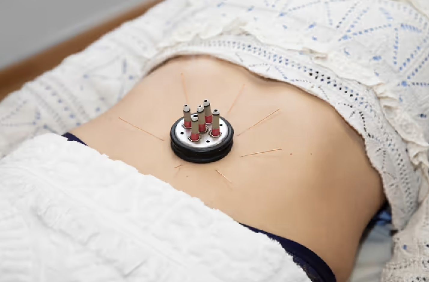 Una mujer está acostada en una cama con un dispositivo en su estómago.