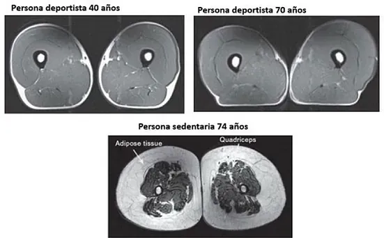 Una imagen en blanco y negro de la rodilla de una persona.