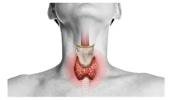 Un primer plano del cuello de una persona con una glándula tiroides visible.