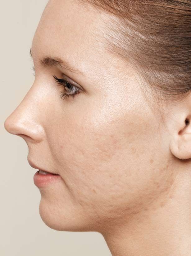 natural-face Robert Patrick van der Kruijssen