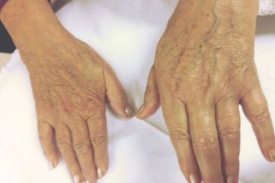 Hände, Physiotherapie und manuelle Lymphdrainage Anna Bucher
