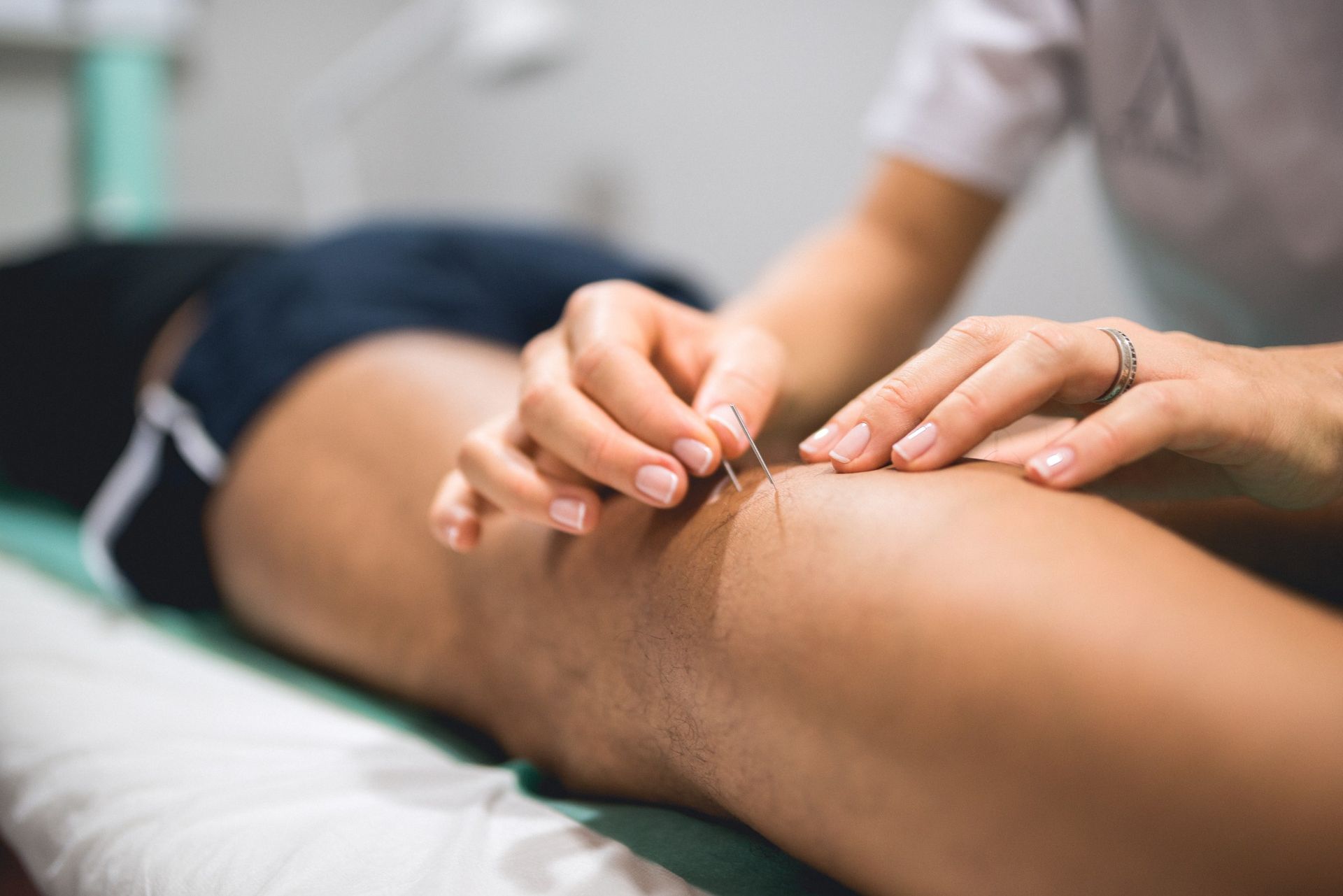 Una persona está recibiendo acupuntura en su pierna.