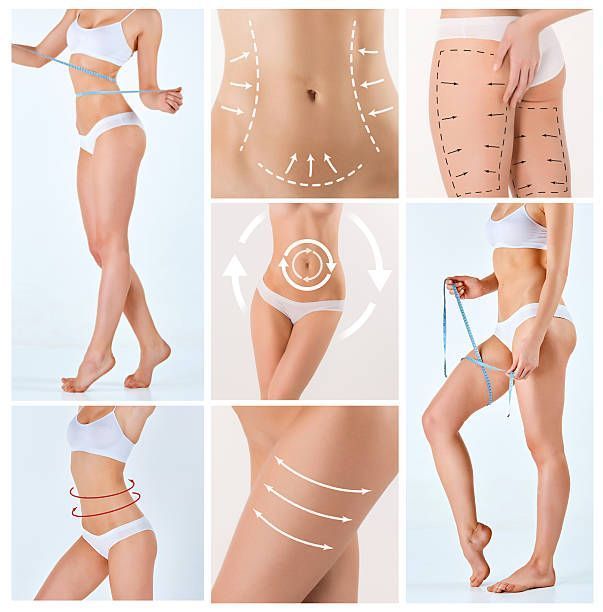 Des corps de femmes.