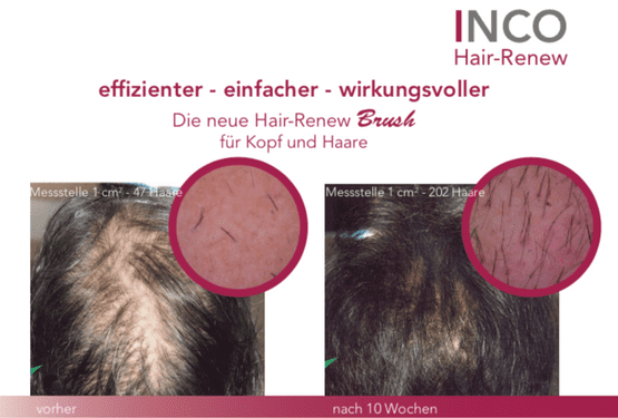 Kosmetikinstitut about beauty - Zürich Gesicht und Körperbehandlung