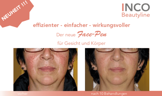Kosmetikinstitut about beauty - Zürich Gesicht und Körperbehandlung