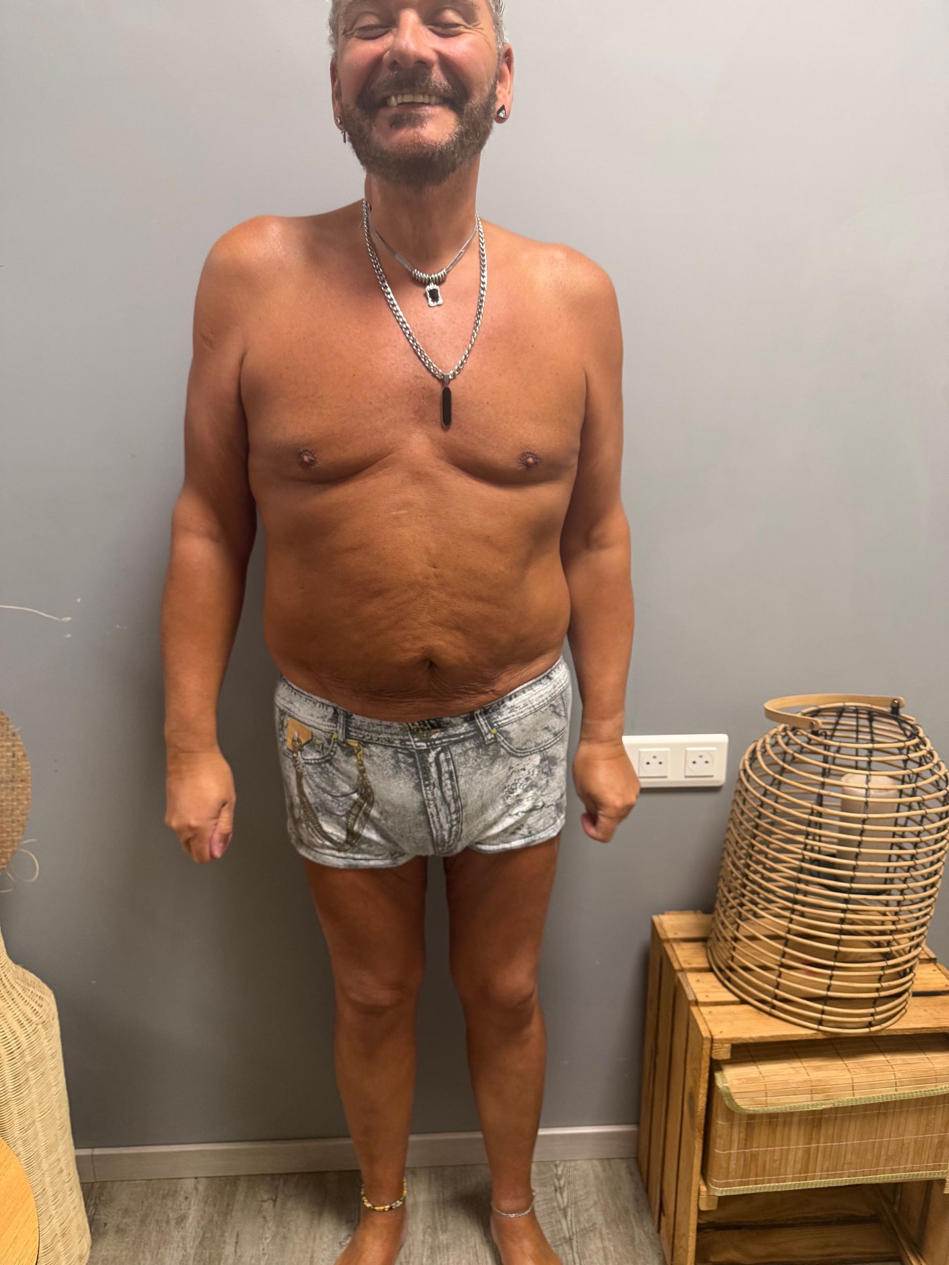 Photo de face du ventre d'un homme après traitement.