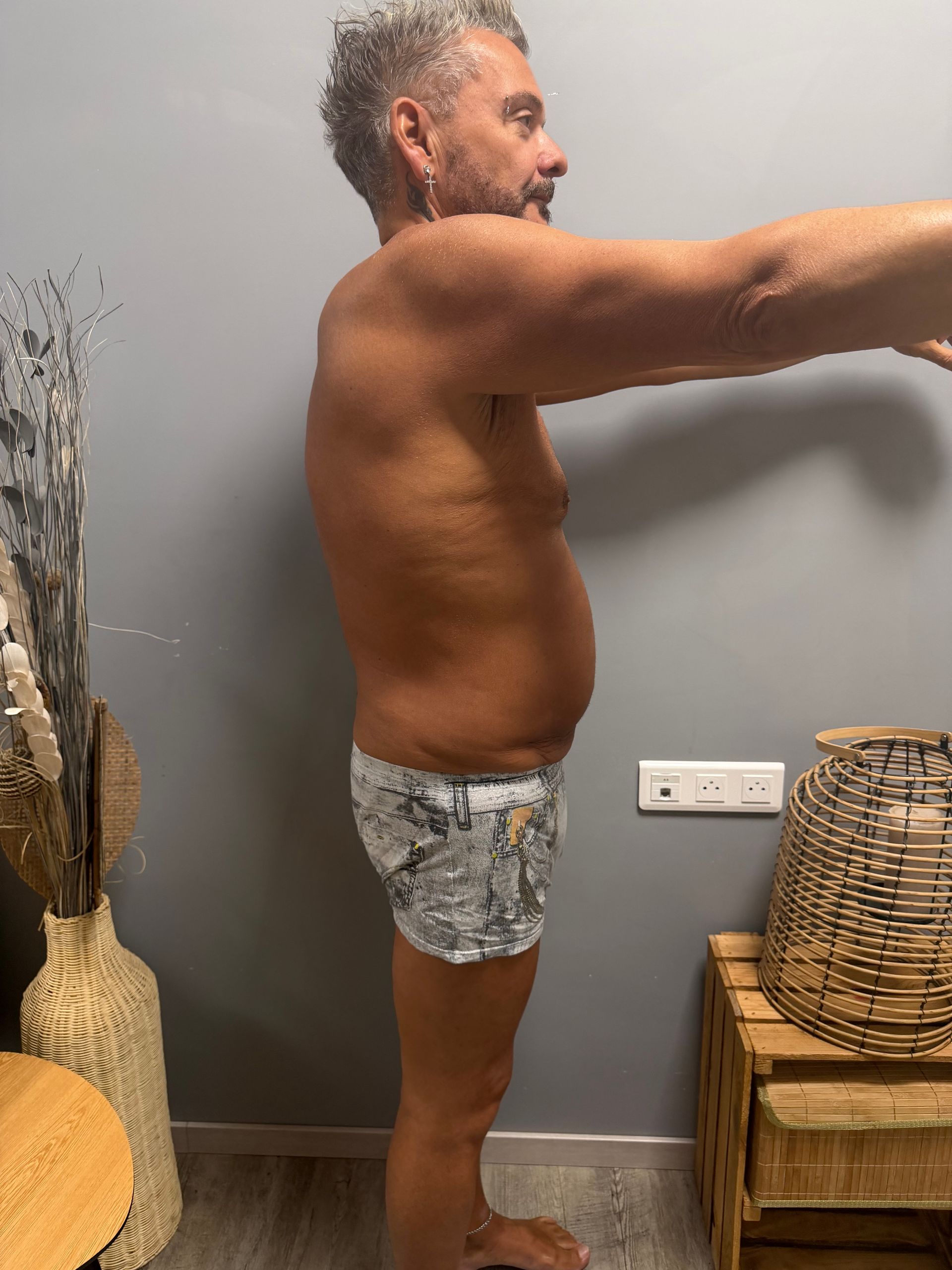 Photo de profil du ventre d'un homme après traitement.