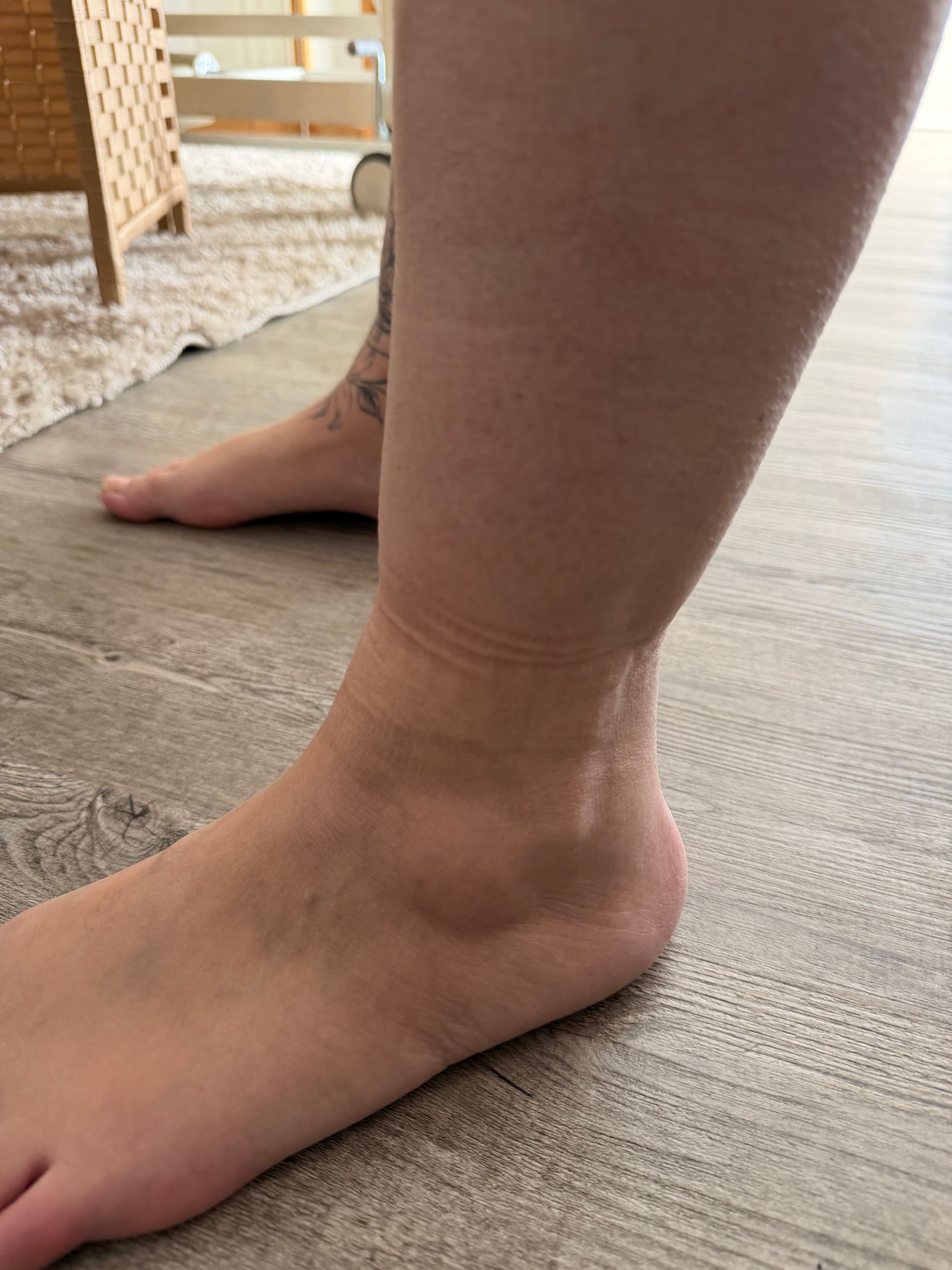 Les jambes d'une femme après drainage lymphatique.