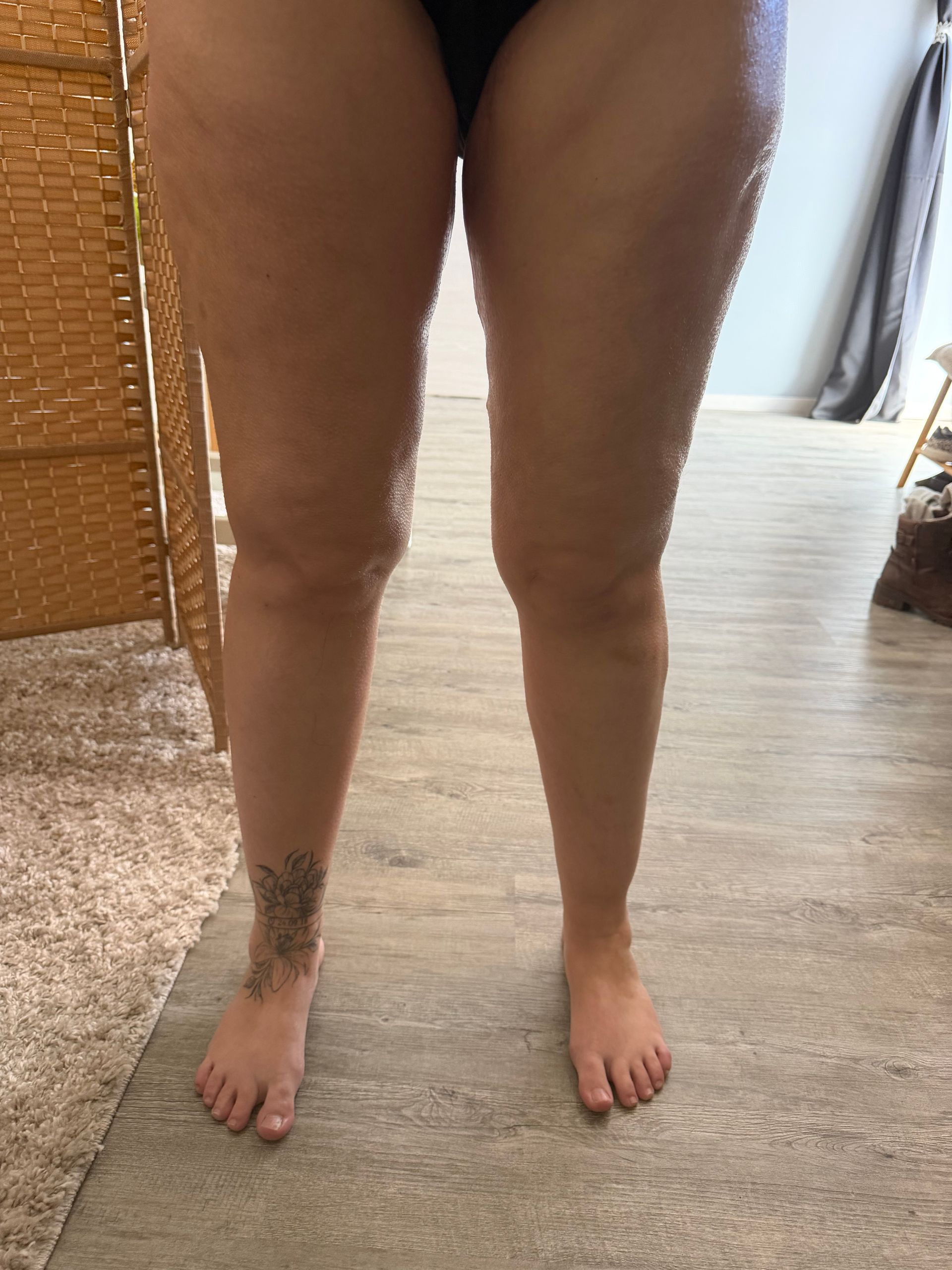 Photo de face des jambes d'une femme après drainage lymphatique.
