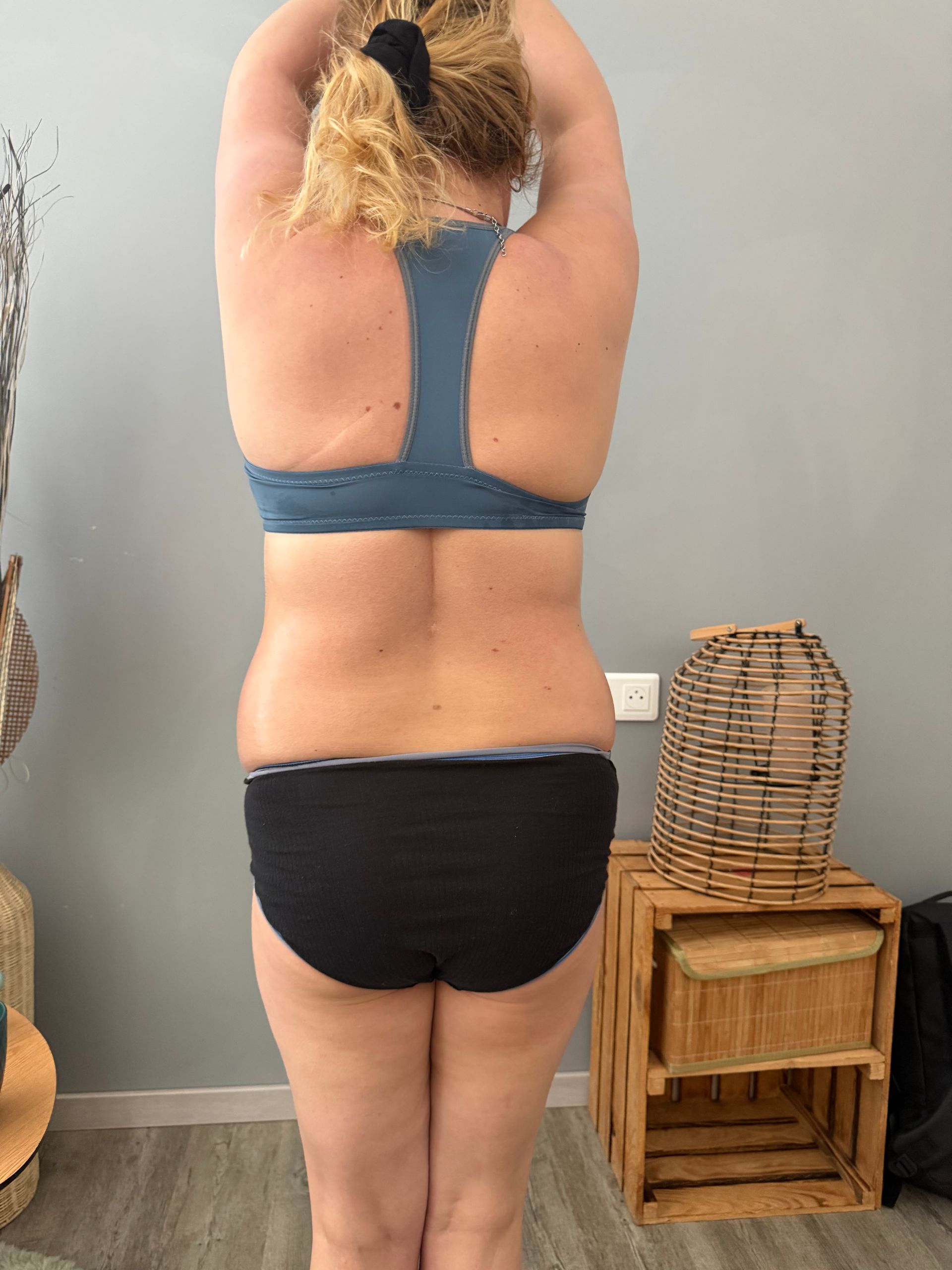 Photo du ventre d'une femme de dos après un traitement avec Révélya.