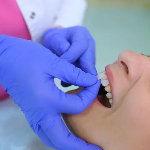 Una mujer se está haciendo examinar los dientes por un dentista que lleva guantes azules.