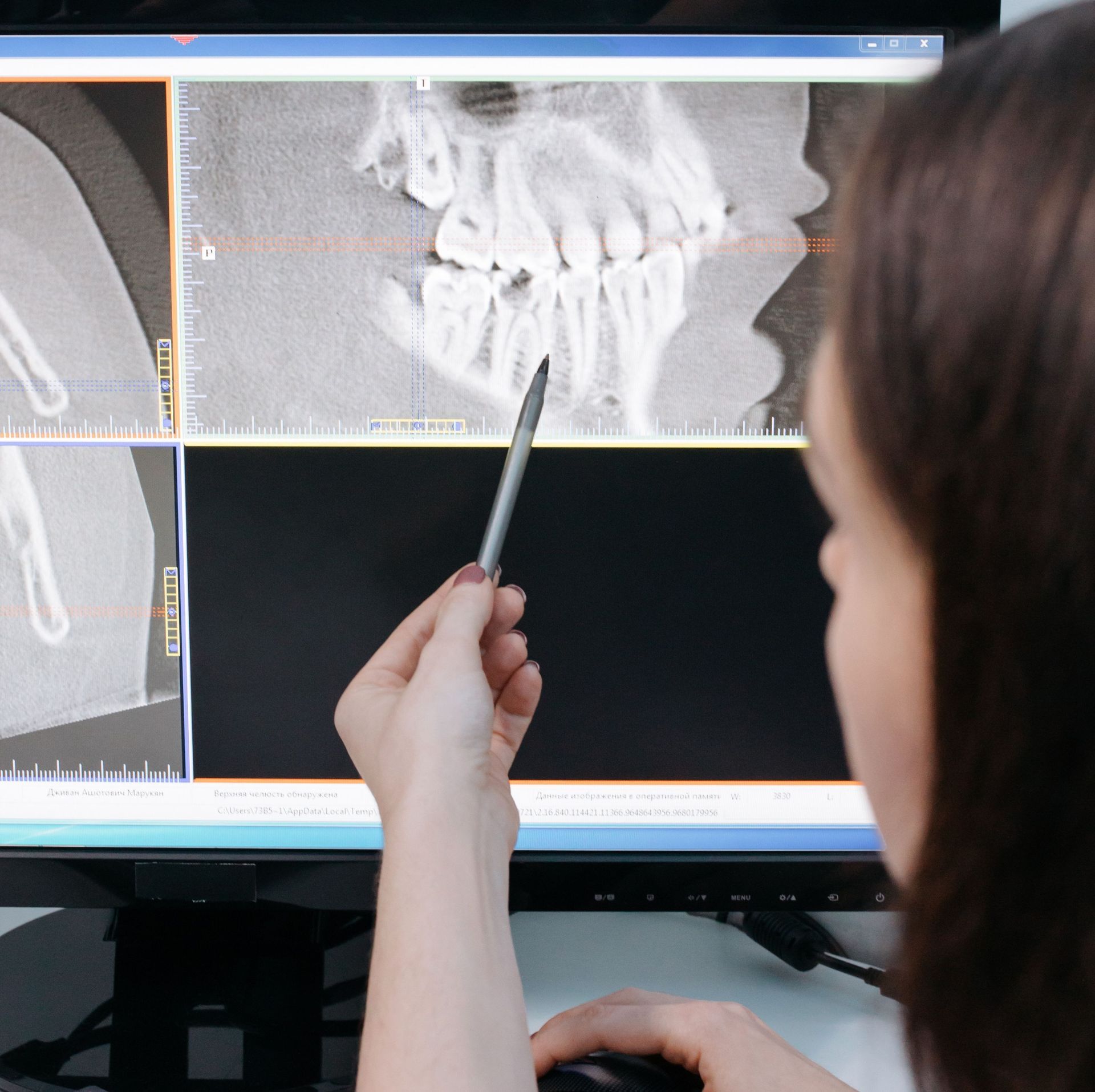 Una mujer está mirando una radiografía de sus dientes en una pantalla de computadora.