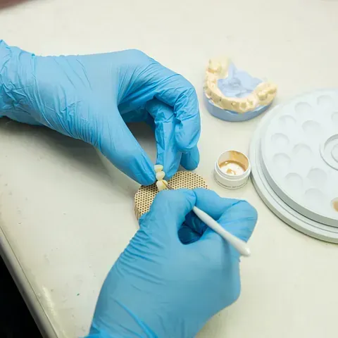Una persona que lleva guantes azules está trabajando en un modelo dental.