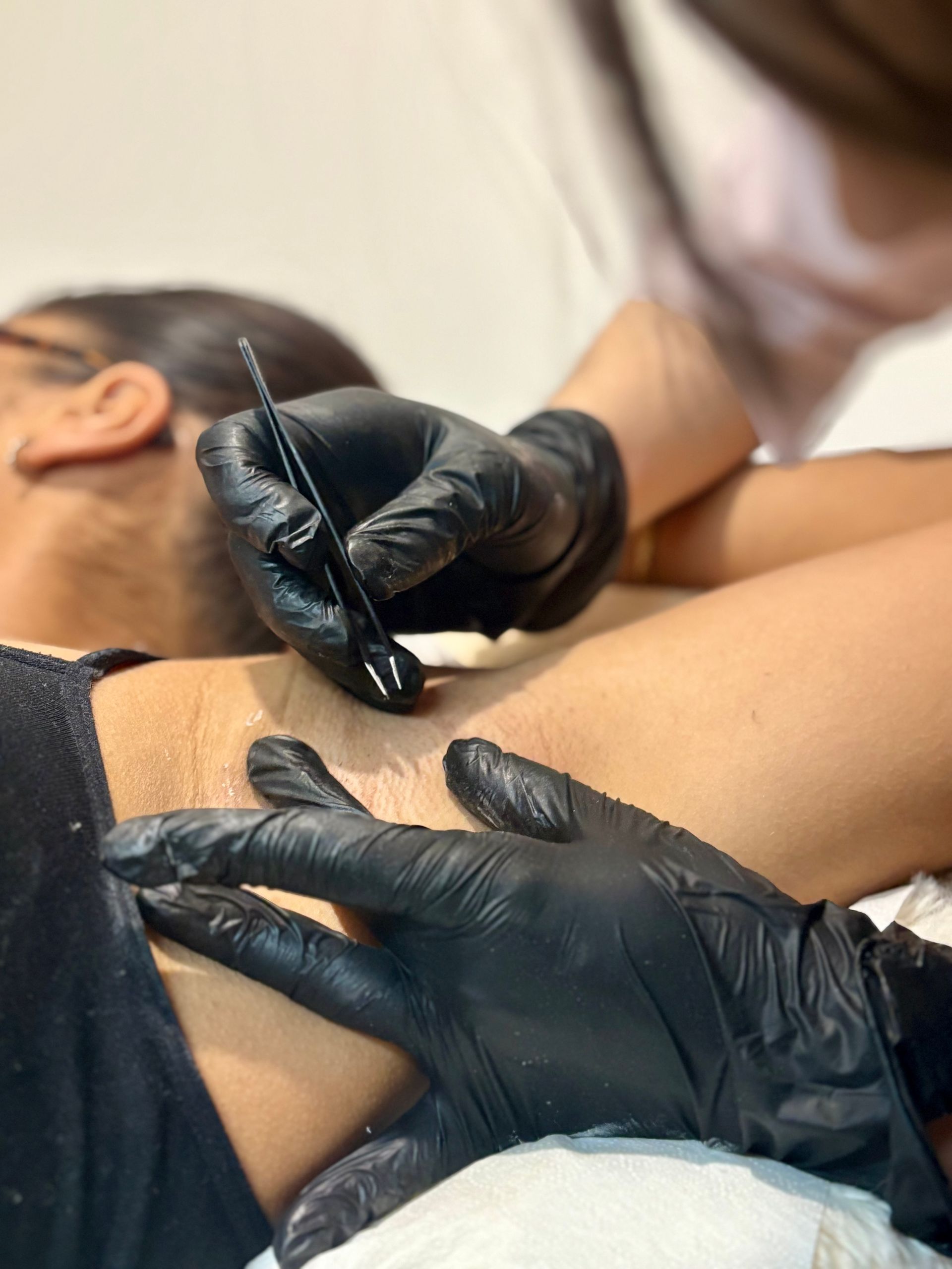 Une personne portant des gants noirs utilise une pince à épiler pour épiler des aisselles.