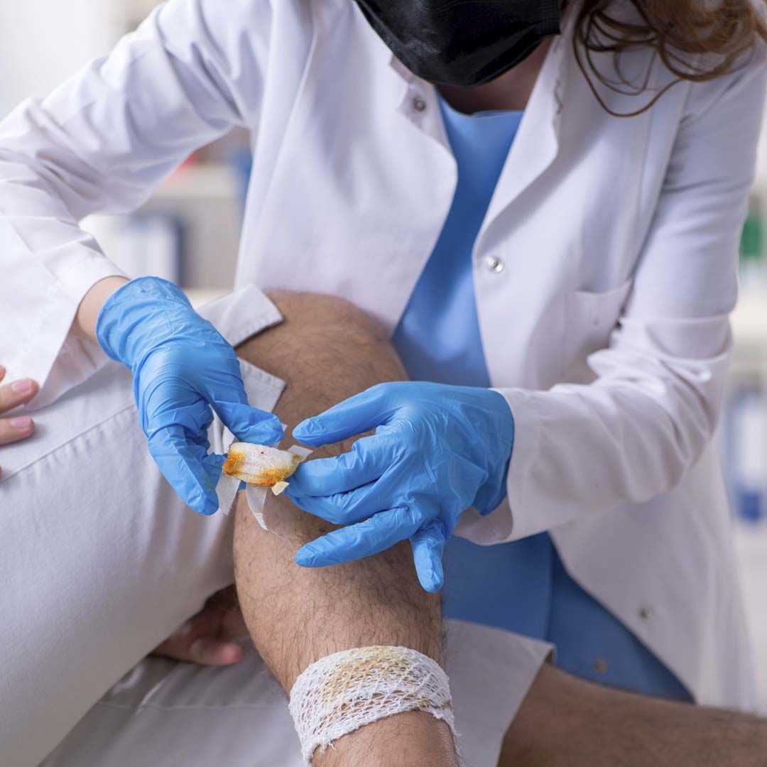 Un médico que lleva una máscara y guantes azules está aplicando un vendaje en la pierna de un paciente.
