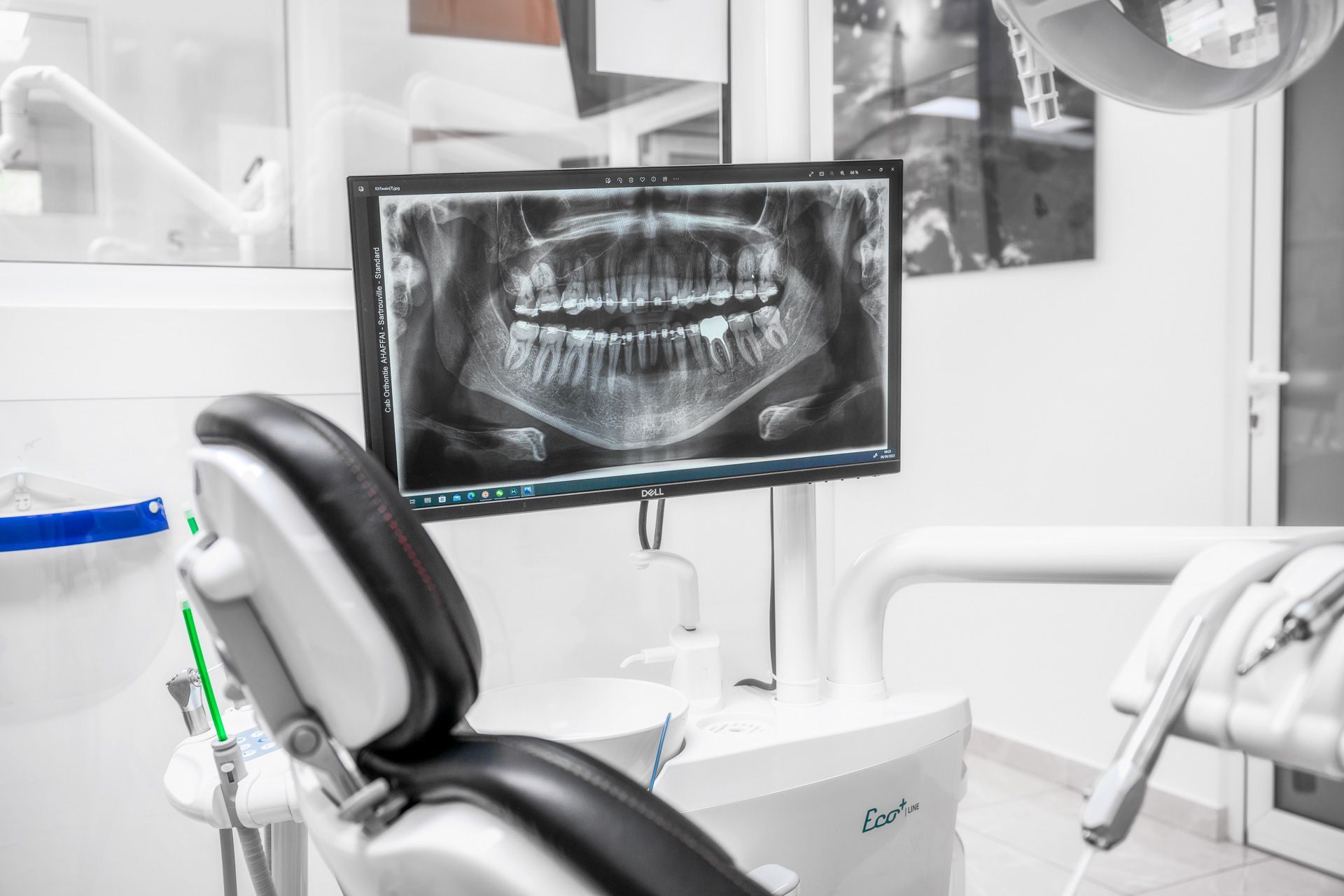 Radio dentaire affichée sur l'écran d'une salle de consultation