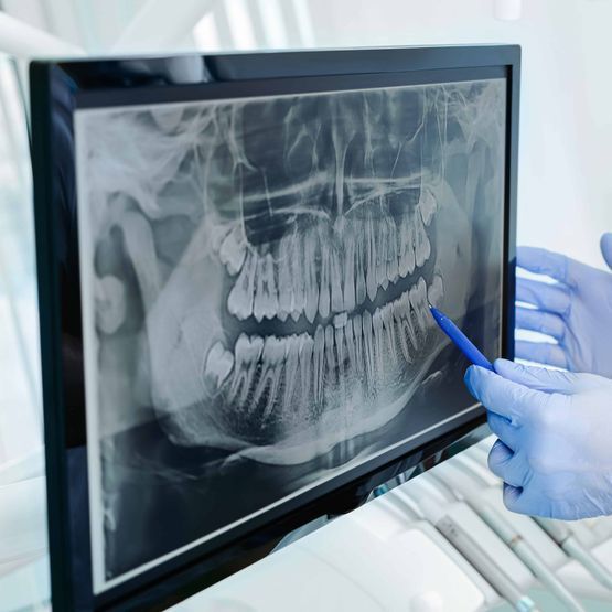 Cabinet dentaire du Léman - Radiographie panoramique 3D - Mies