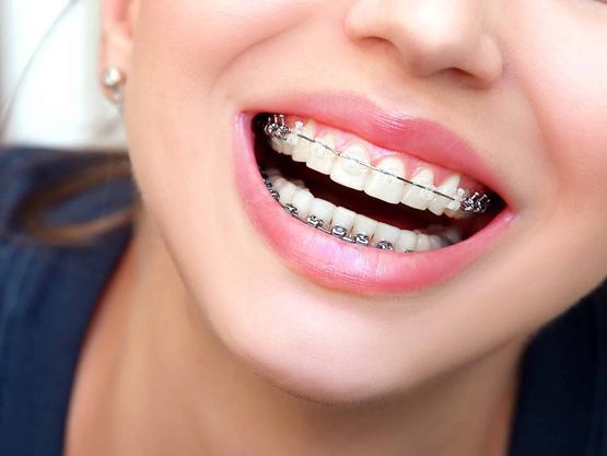 Cabinet dentaire du Léman - Orthodontie enfants, adultes - Mies