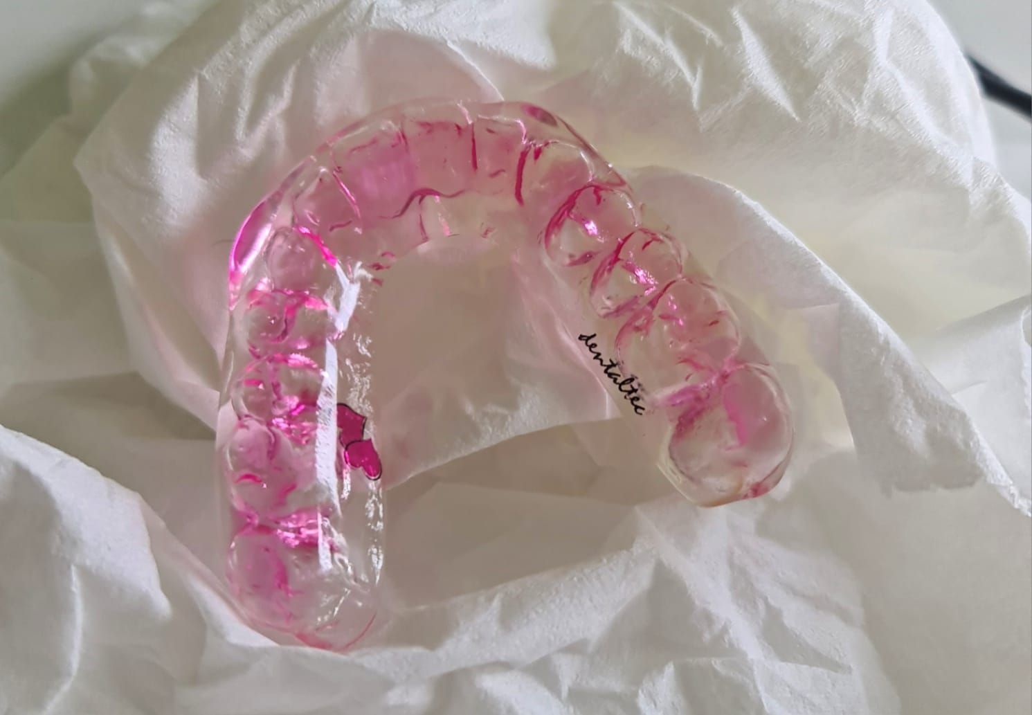 Férula dental transparente de color rosa sobre papel de seda blanco