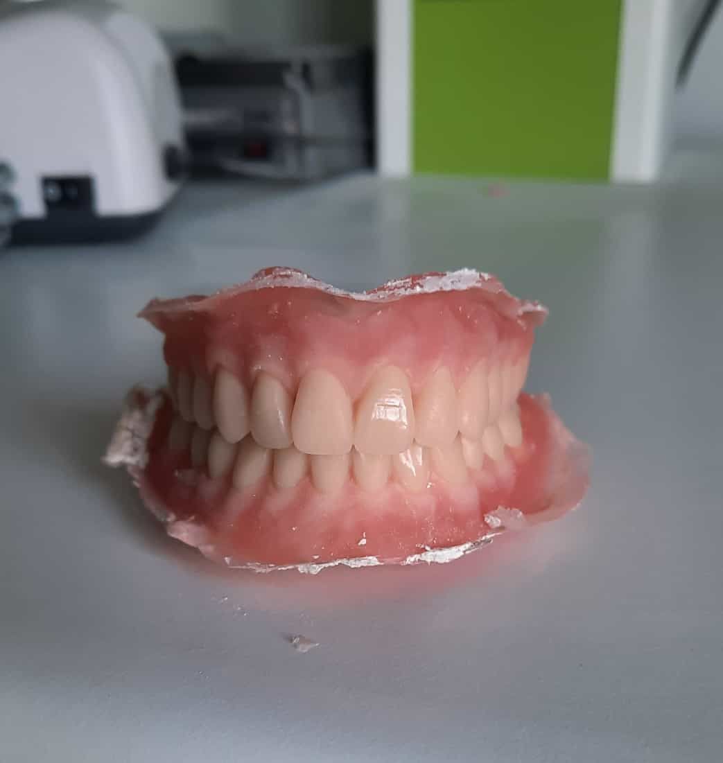 Dentadura con encías rosas y dientes blancos sobre una mesa gris, con un fondo desenfocado