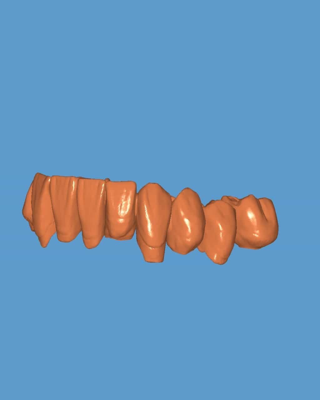 Modelo 3D de un diente naranja sobre un fondo azul