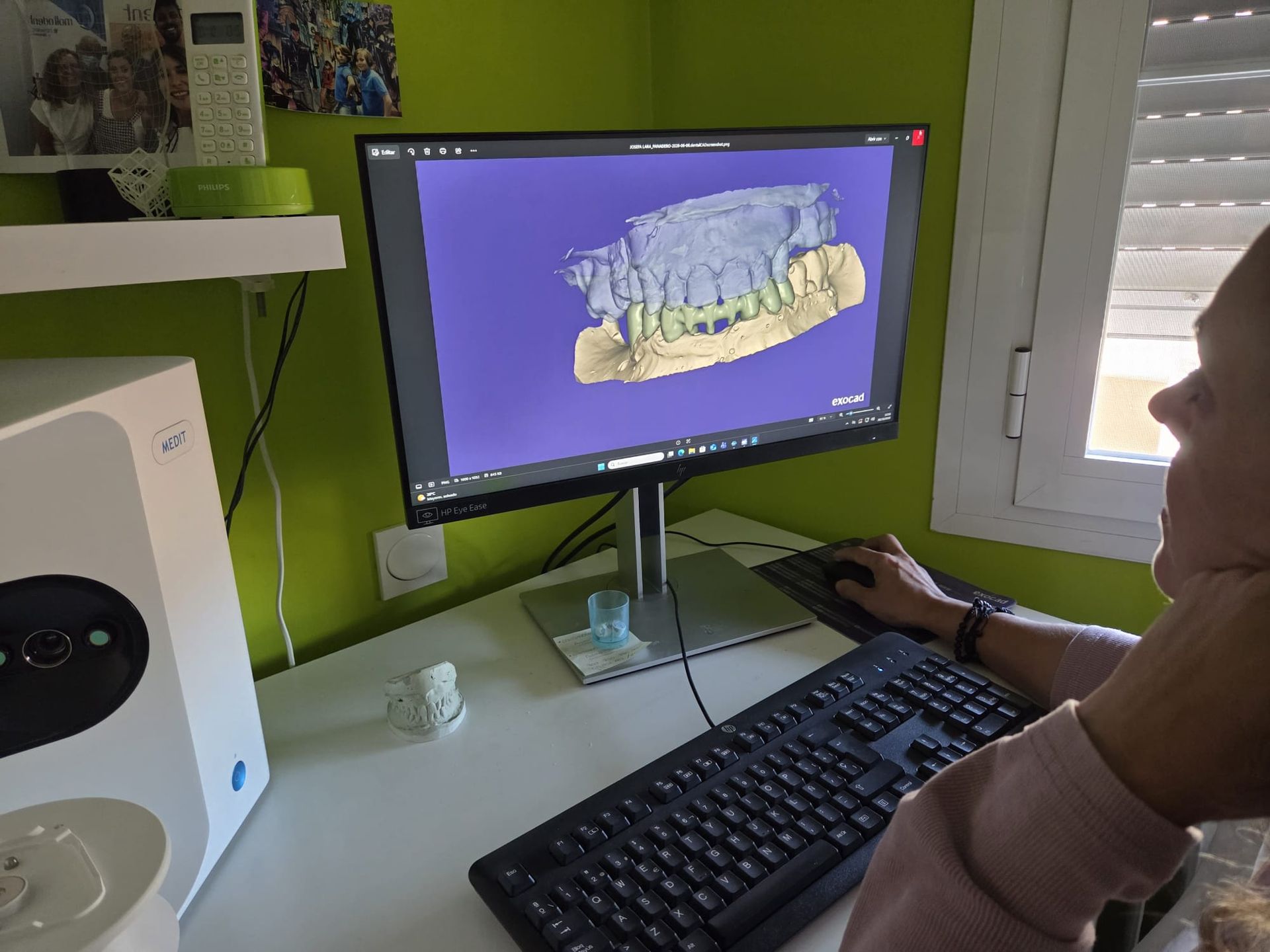 Persona que observa un modelo dental en 3D en un monitor de escritorio, en una oficina con paredes verdes