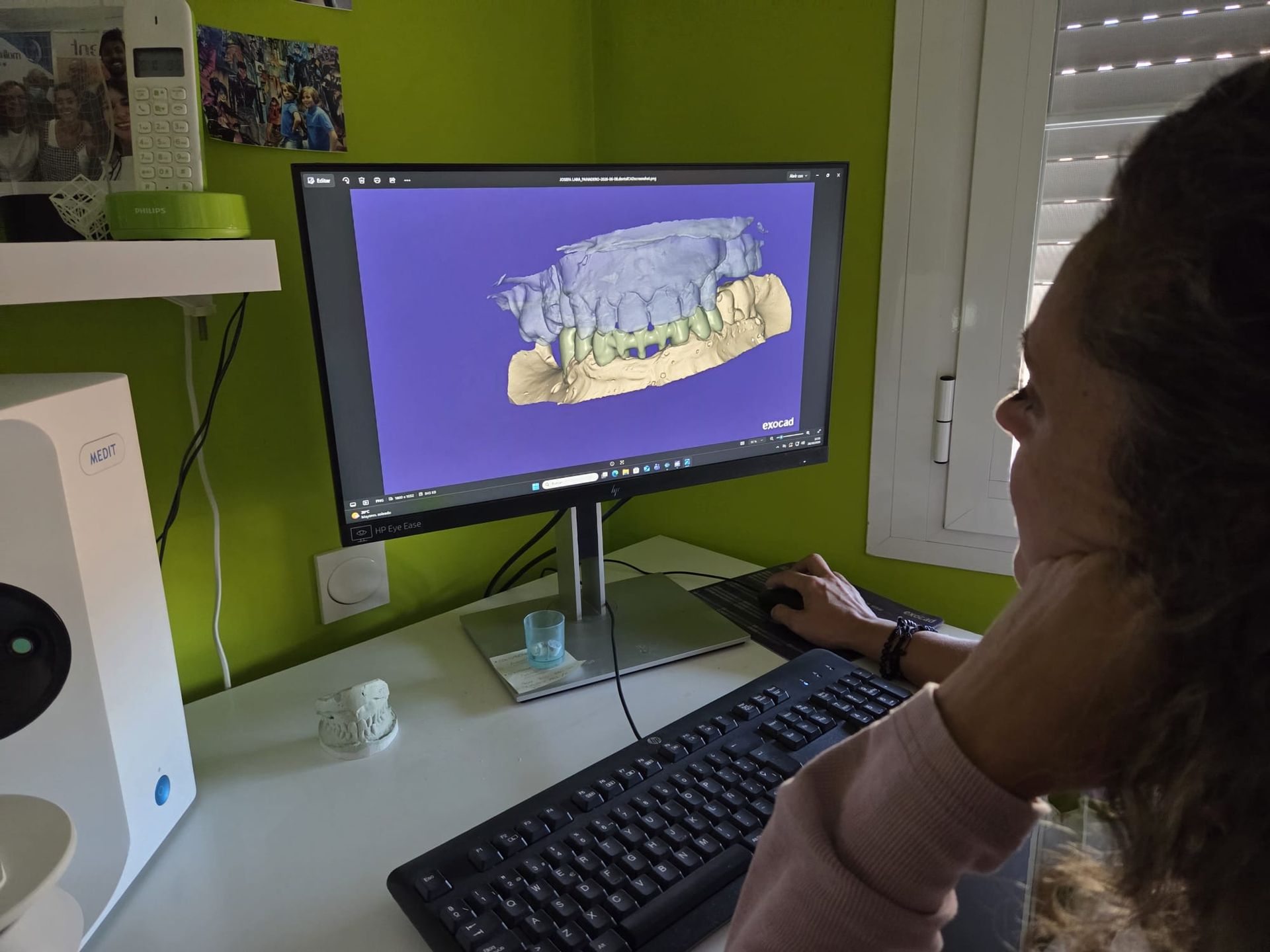 Persona mirando un monitor de computadora que muestra un modelo dental en 3D en una oficina en casa