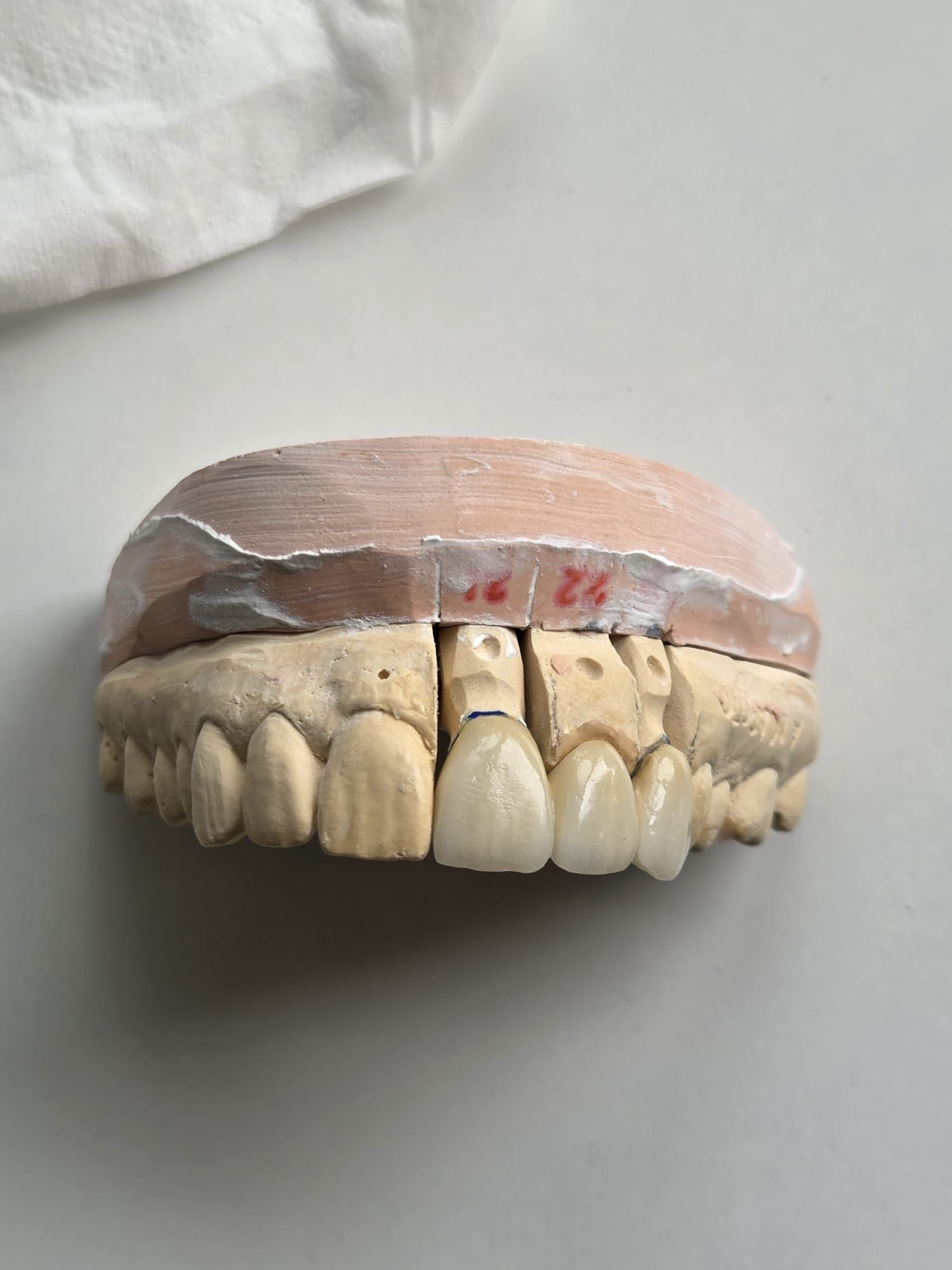 Molde de dentadura con dientes superiores e inferiores sobre una superficie blanca