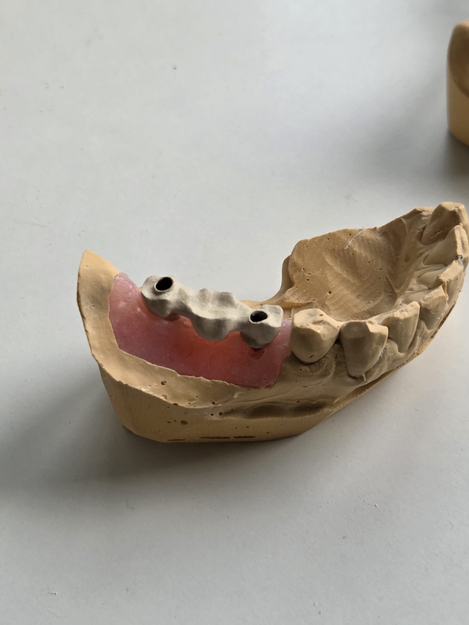 Molde dental con una sección rosa que representa las encías y las marcas de los dientes blancos sobre una superficie blanca