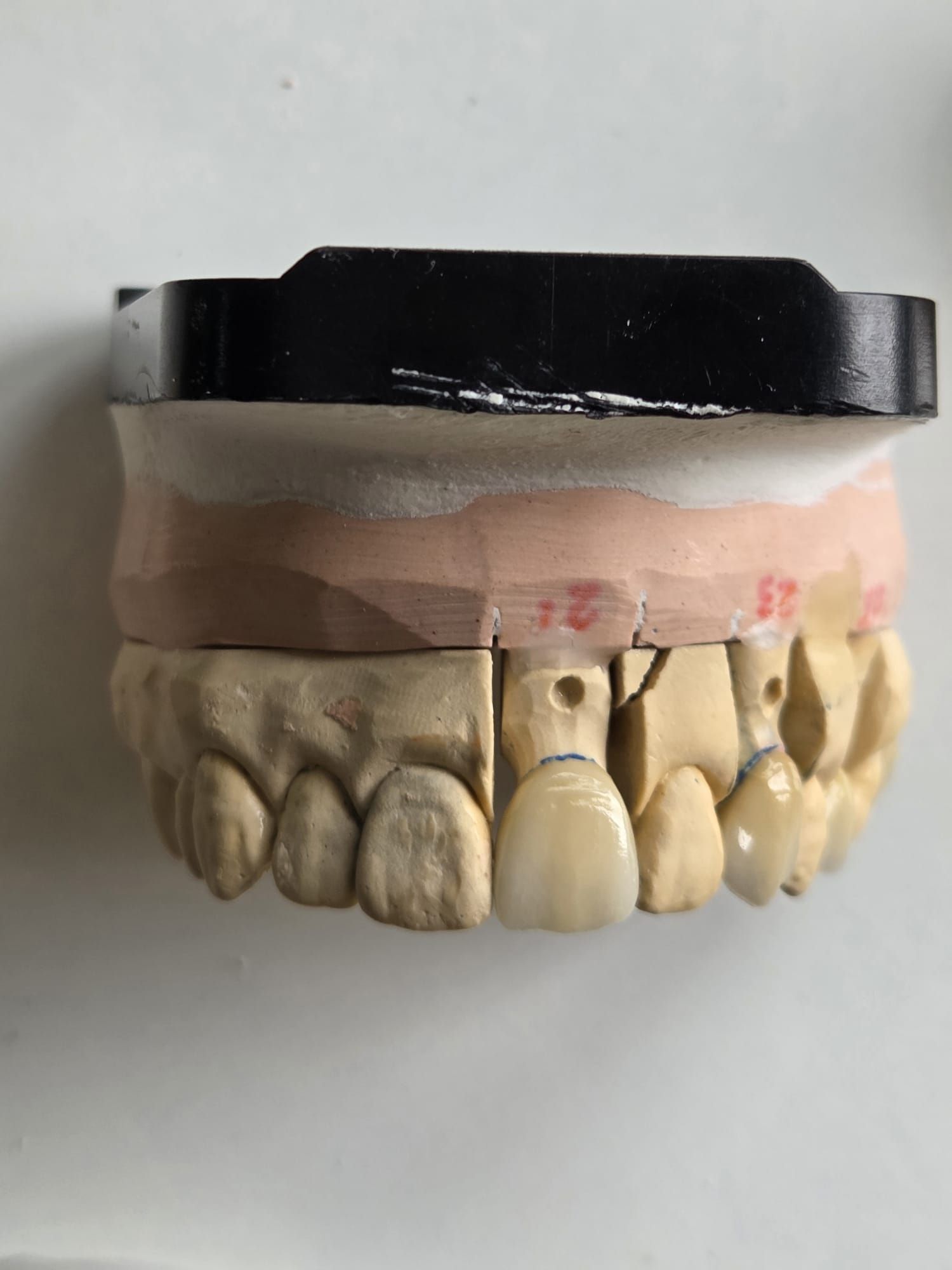 Modelo dental con dientes superiores e inferiores sobre un fondo blanco