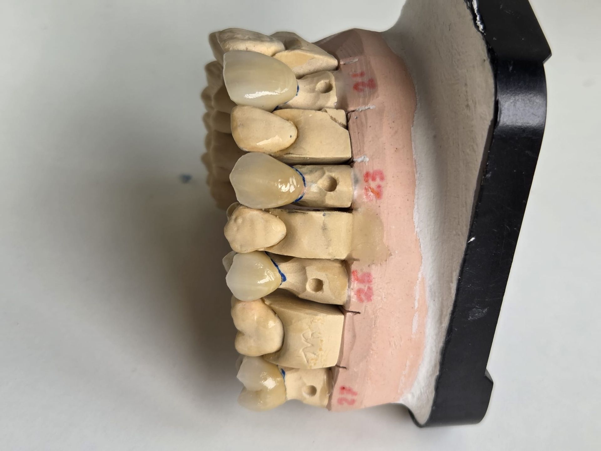 Modelo dental con dientes beige y encías rosas sobre una base negra, visto de perfil.