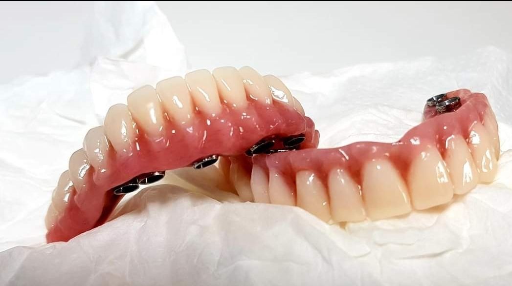 Dos filas de dentaduras postizas rosas sobre un pañuelo blanco, con una de ellas parcialmente abierta y con detalles negros en las encías