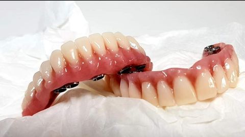 Modelo dental de una mandíbula inferior con encías rosas y dientes blancos sobre una mesa de laboratorio