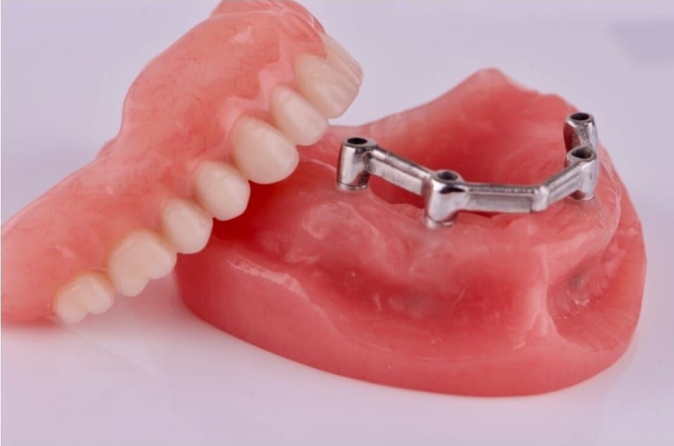 Un dentista examina un molde dental en una mesa de laboratorio, con herramientas y un microscopio cerca
