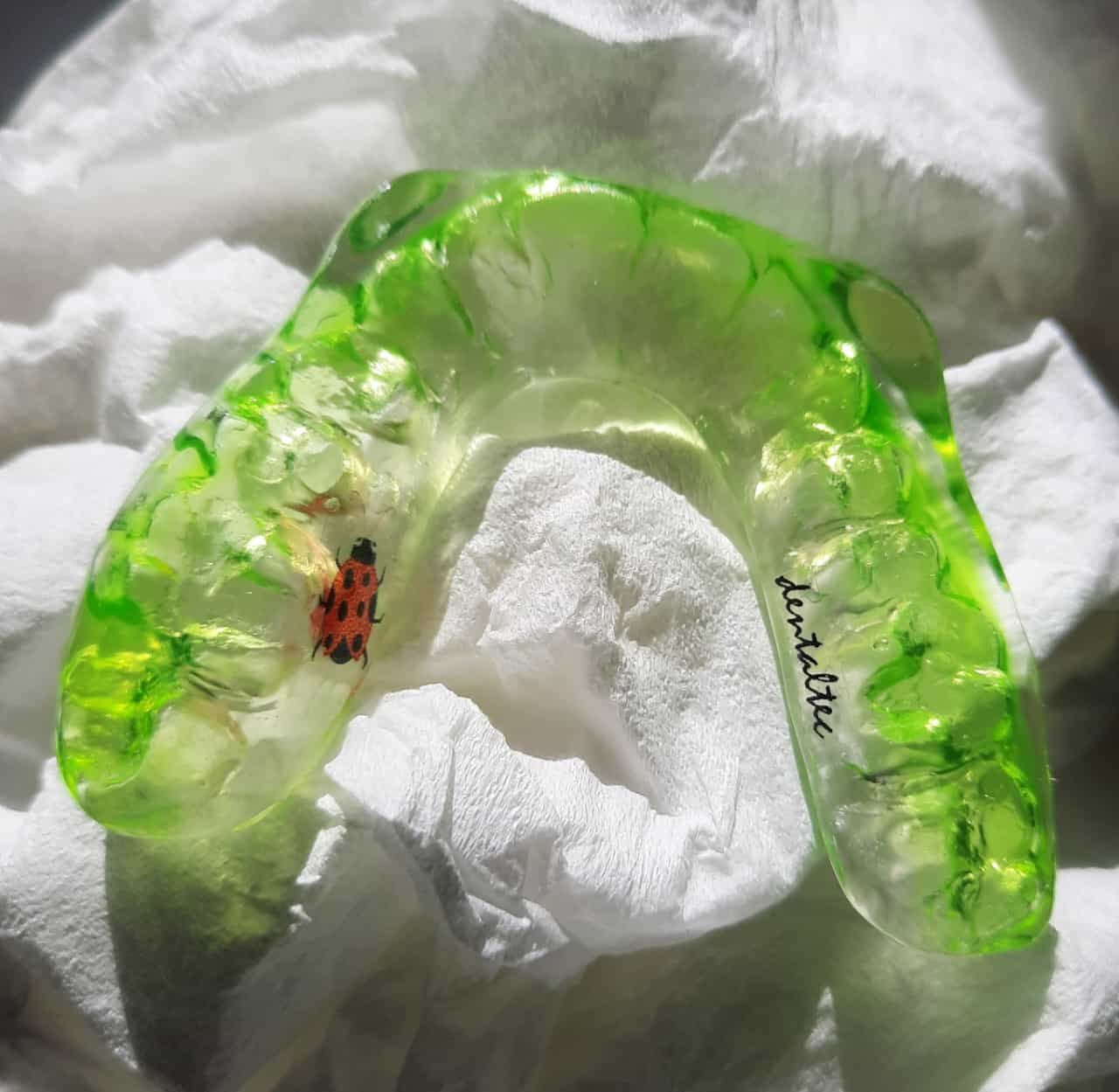 Retenedor dental translúcido de color verde brillante sobre un pañuelo blanco, con una pequeña mariquita roja dentro.