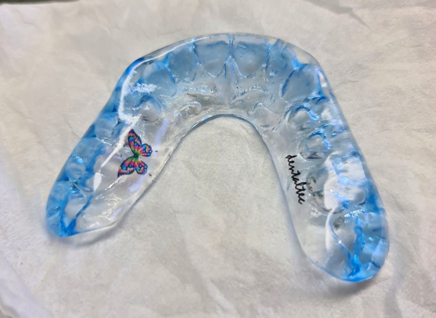Manos enguantadas moldeando una impresión dental con herramientas metálicas en una clínica