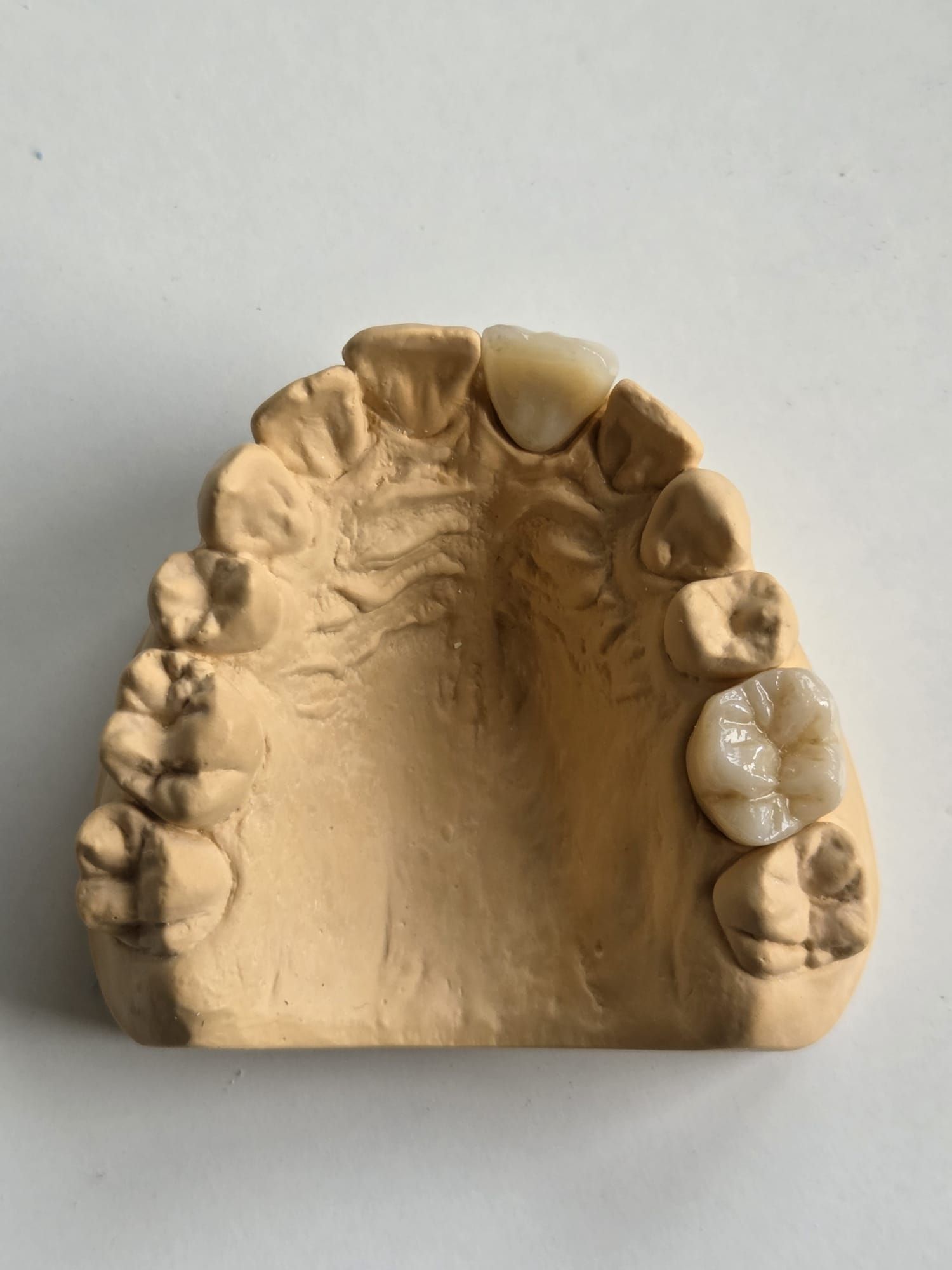 Modelo dental de un maxilar superior con dientes, visto desde arriba sobre un fondo liso