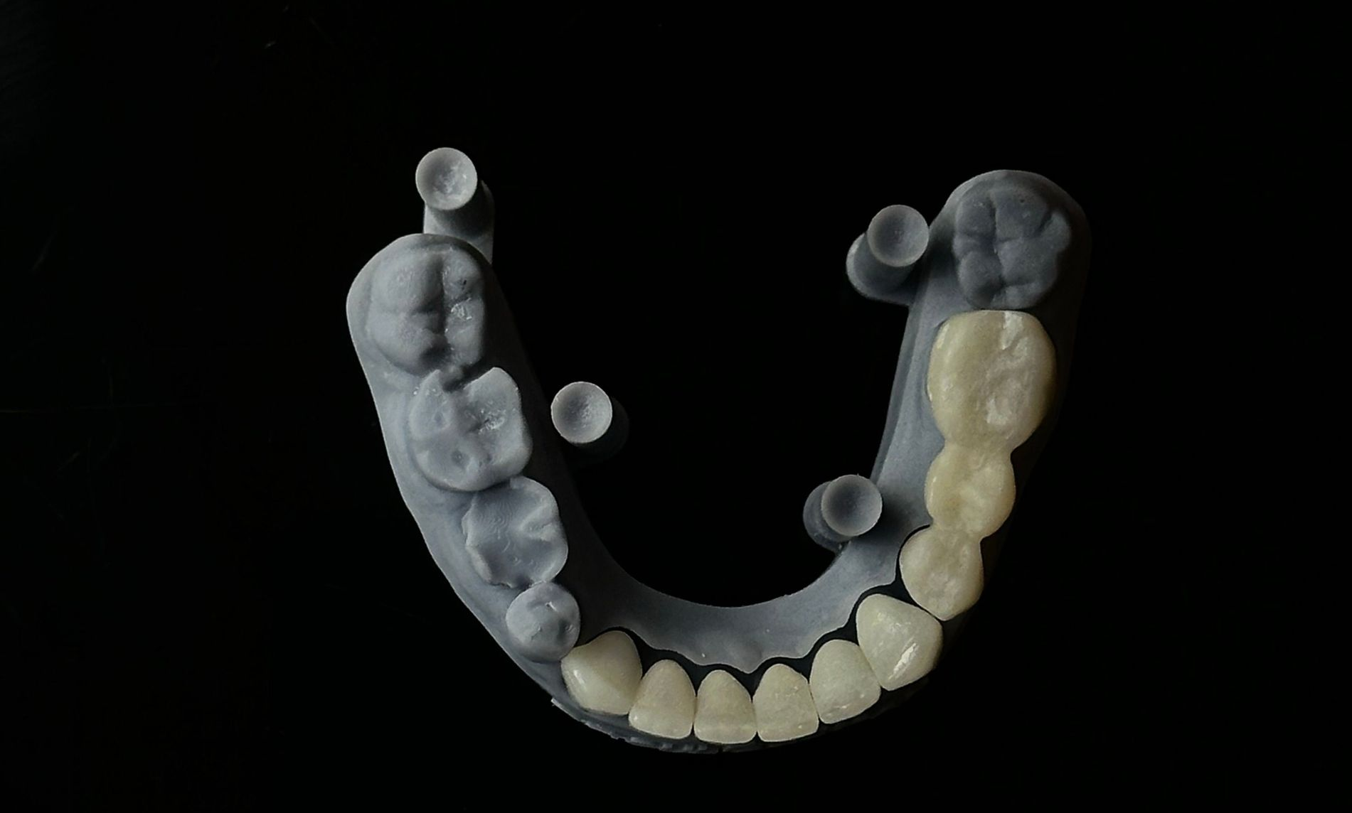 Vista superior de una arcada dental con dientes blancos y grises sobre un fondo negro