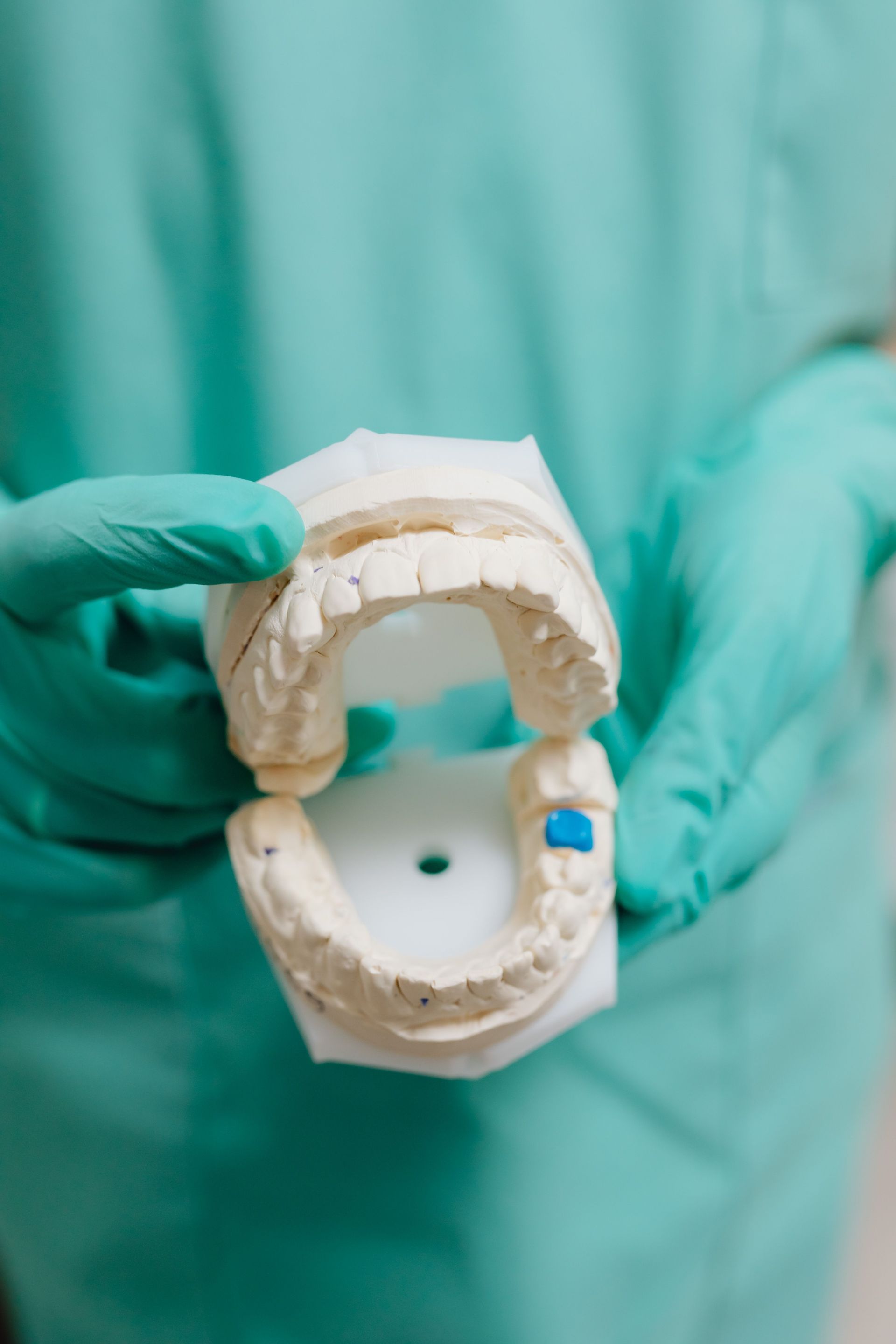 Manos enguantadas sosteniendo un molde dental con una base circular blanca y puntos marcados en azul