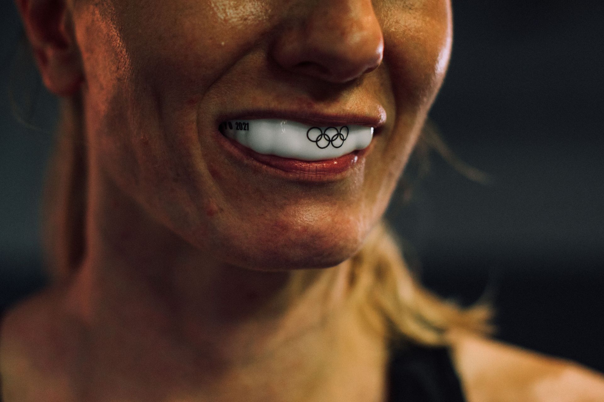 Primer plano de una boca sonriente con brackets plateados, luz cálida y un fondo oscuro desenfocado