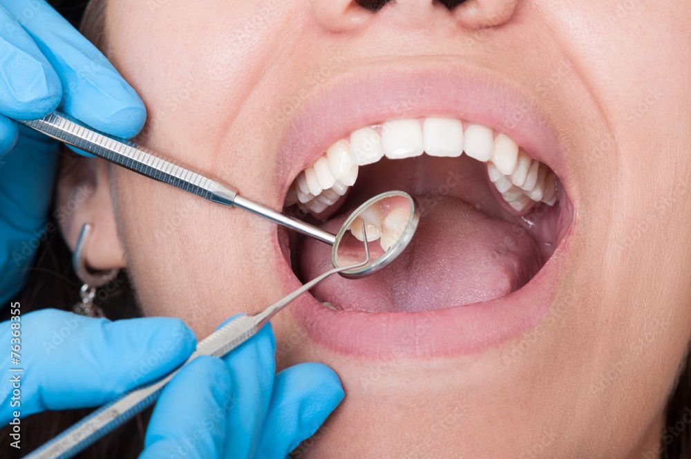Zahnarzt untersucht den geöffneten Mund eines Patienten mit Zahnspiegel und Instrumenten