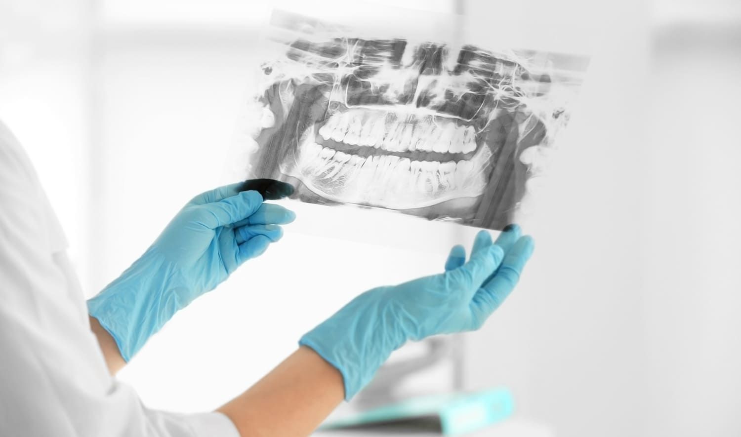 Un dentista sostiene una radiografía de los dientes de una persona.
