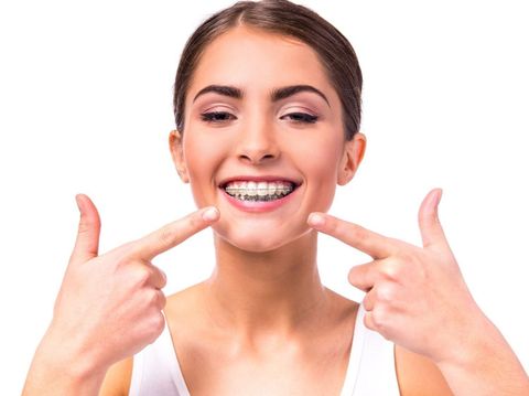 Una mujer con aparatos dentales sonríe y señala sus dientes.