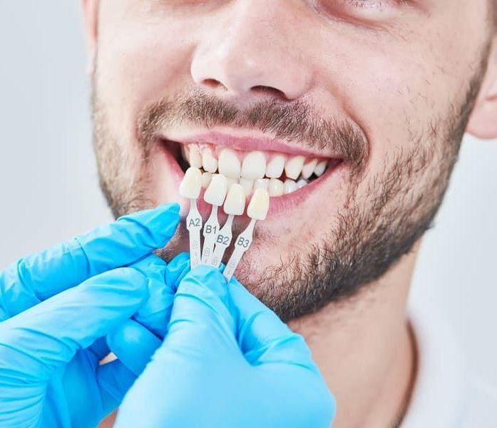 Un hombre está siendo examinado por un dentista.