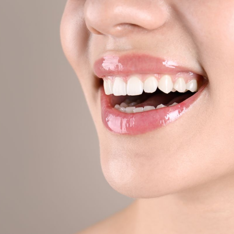 Gros plan sur une bouche souriante avec un rouge à lèvres rose brillant, dévoilant des dents blanches.