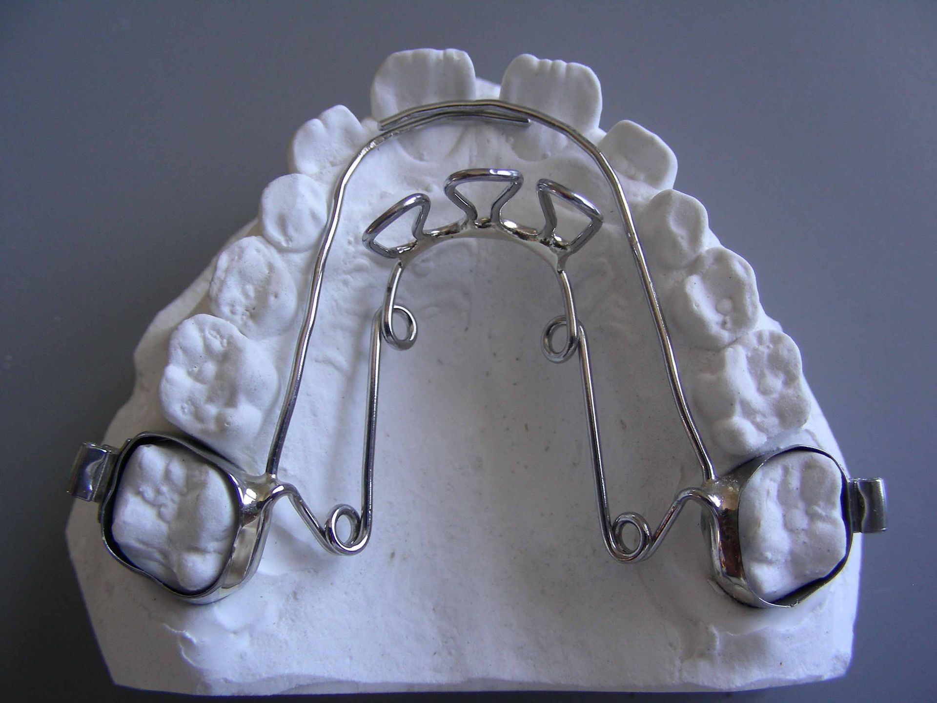 Quad - hélix langue