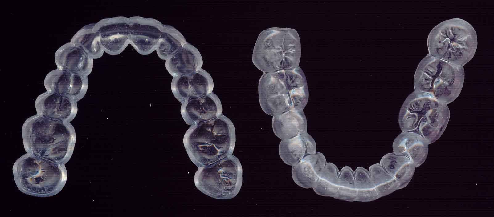 blanchiment - orthodontiques-dentision