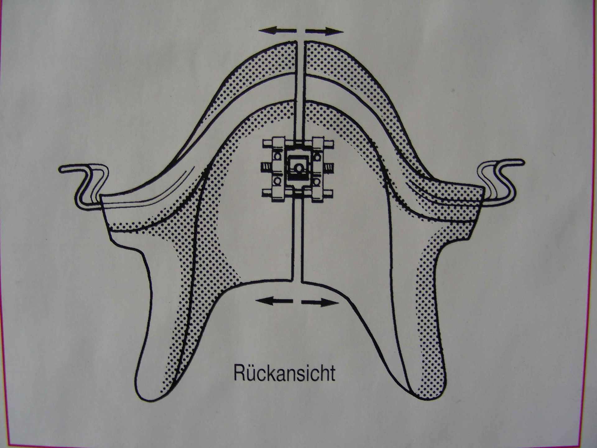 croquis-monobloc Dentision
