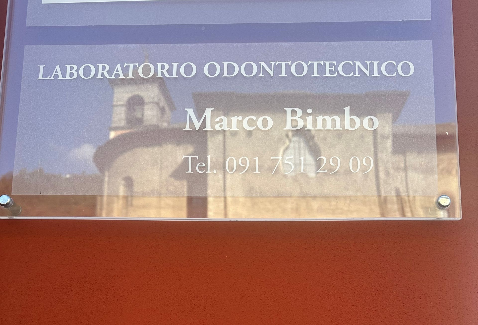 Rendering wireframe dei denti di una mascella, che mostra la struttura dentale dettagliata.