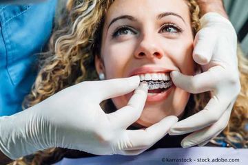 Behandlung bei Zahnarzt Praxis Christian Eis